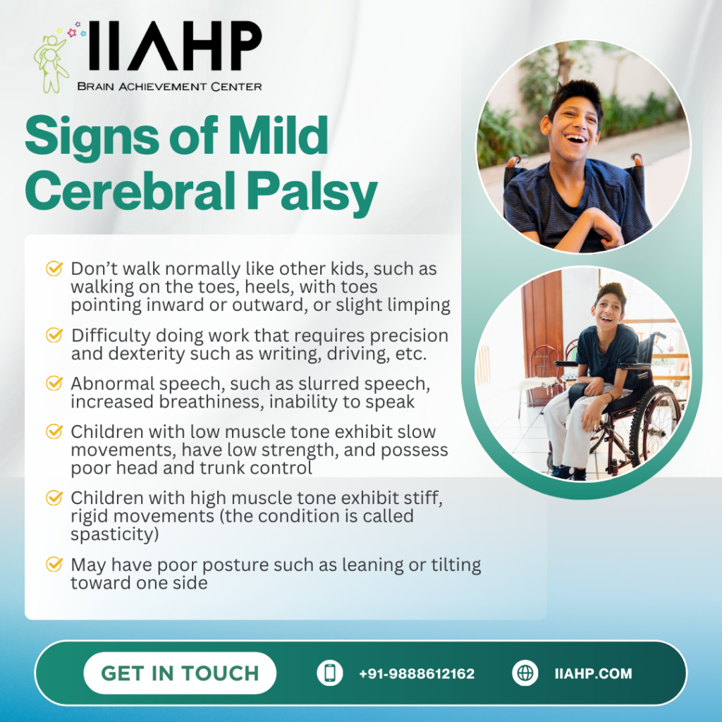 Mild Cerebral Palsy Treatment